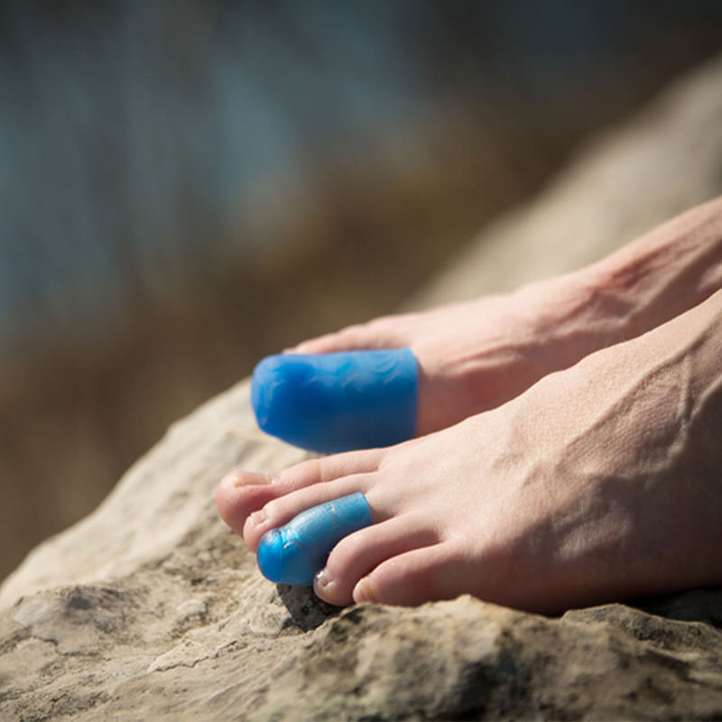 Zwei Füße mit blauen Gel-Zehenschutzkappen auf einem Felsen.